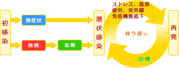 口唇ヘルペスは再発予防できます