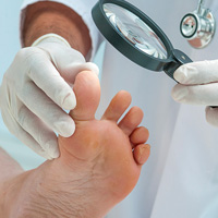 足の爪水虫、症状と治療法