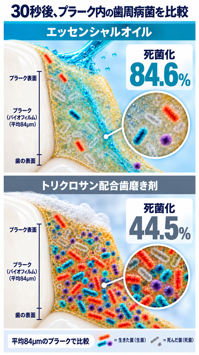 エッセンシャルオイルとトリクロサン配合歯磨き剤のプラーク内歯周病菌の比較