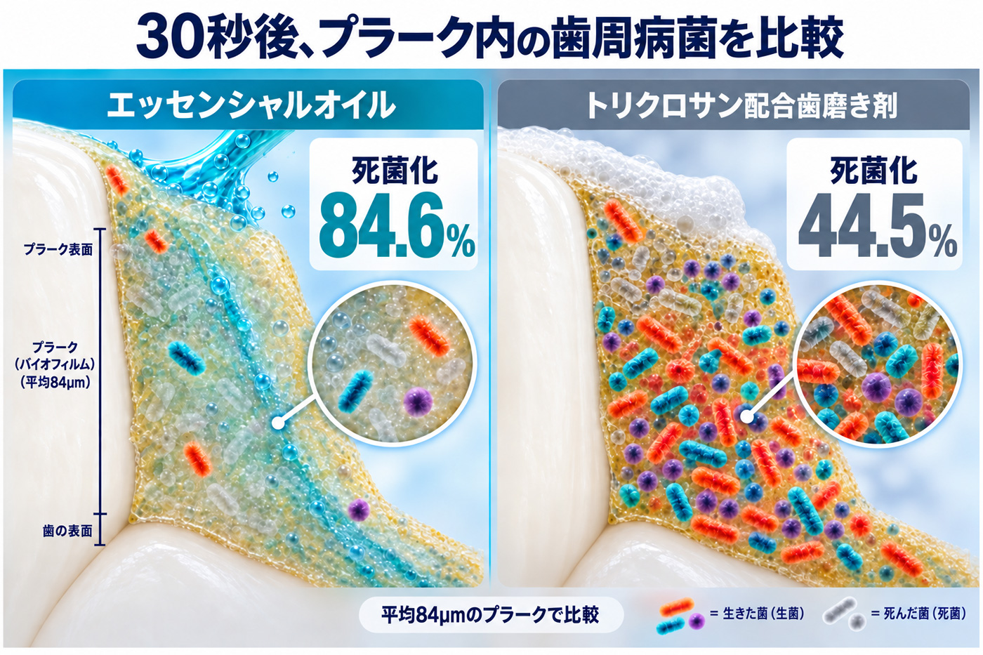 エッセンシャルオイルとトリクロサン配合歯磨き剤のプラーク内歯周病菌の比較