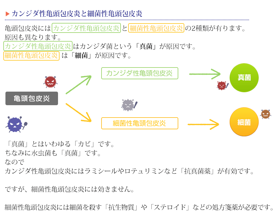 カンジダ性亀頭包皮炎と細菌性亀頭包皮炎