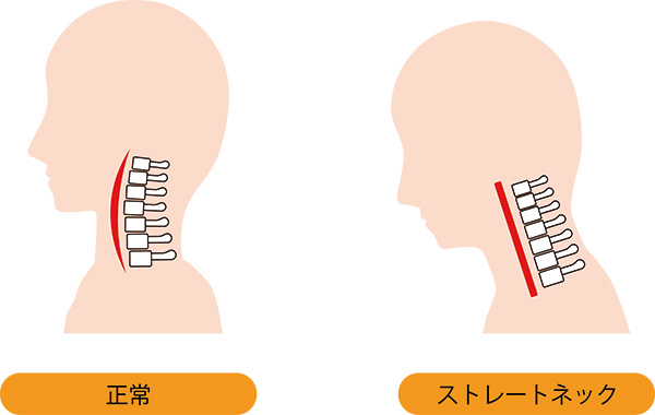 首