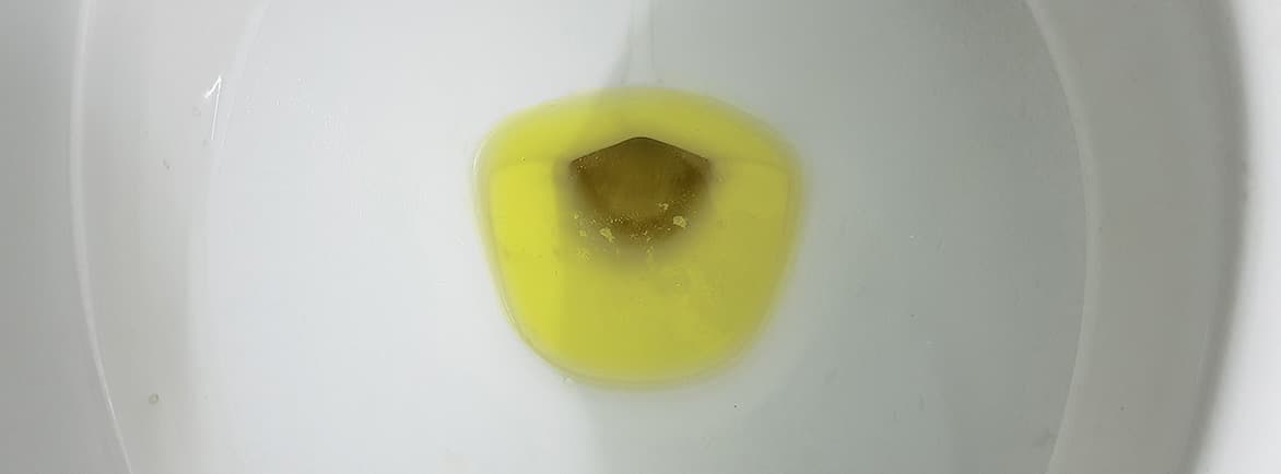 尿が真っ黄色