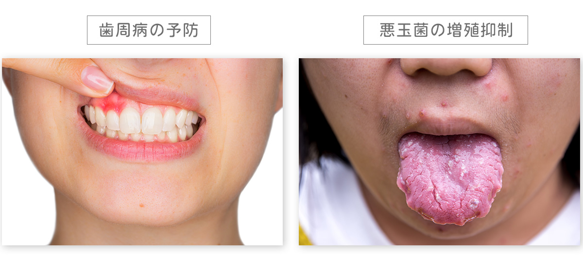 「歯周病の予防」「悪玉菌の増殖抑制」する２つの乳酸菌