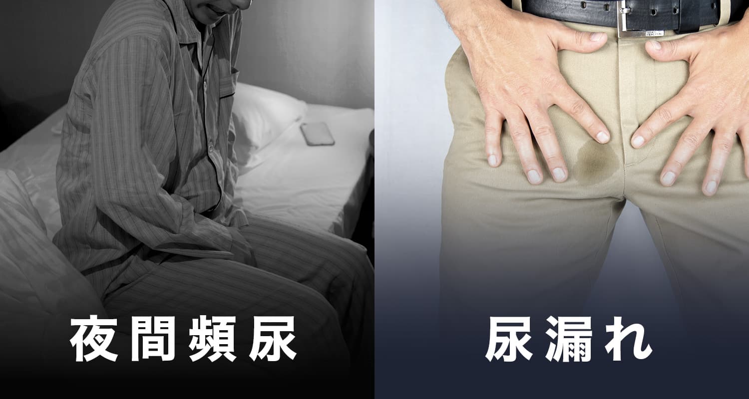 加齢に伴う深刻な悩み