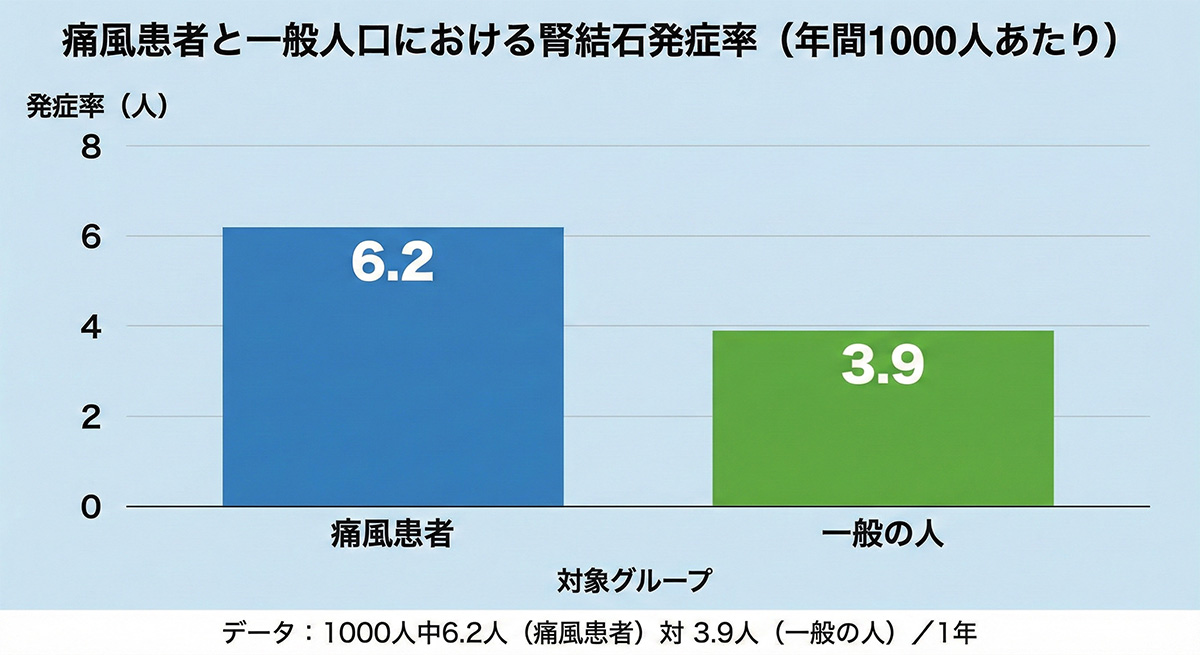痛風患者の腎結石発症率1000人中6.2人 ／1年 一般の人では1000人中3.9人 ／1年