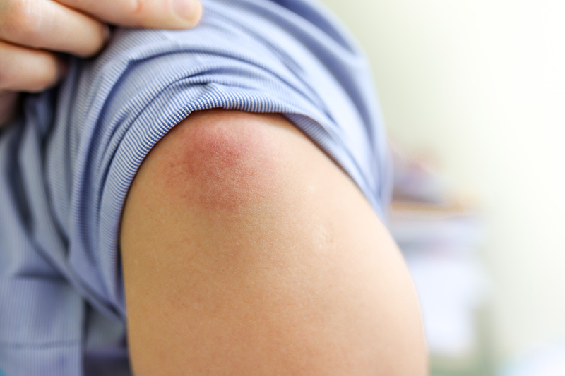 ワクチンの副反応